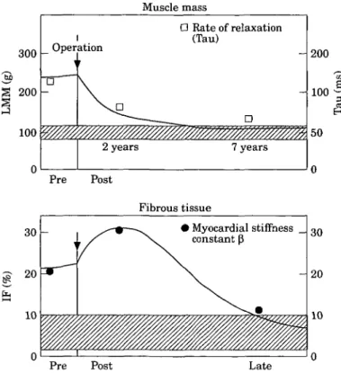 Figure 1 Regression of muscle (top panel) and fibrous mass (bottom panel) in patients with aortic stenosis after successful valve replacement