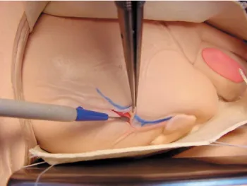Fig. 5. Purpose-built pump to regulate heart rate, stroke volume and arrhythmia induction.