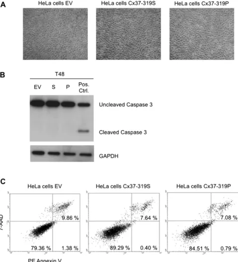 Fig. 2. Cell death in HeLa transfectants. (A) Representative photographs of HeLa cells transfected with EV, Cx37-319S and Cx37-319P after 48 h in culture.