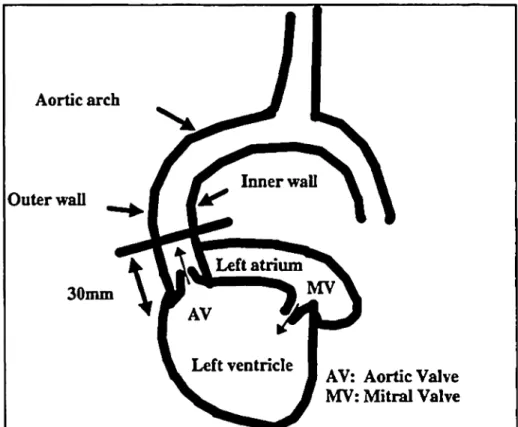 Figur 1: Längsachsenschnitt durch Ventrikel und Aorta. AA: Aufsteigende Aorta, LV: . Linker Ventrikel, RV: