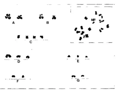 Table lib. Summary of frequencies of aneuploidy and structural aberrations presented in nine previous cytogenetic studies