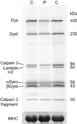 Figure 4. Multiplex western blot showing the marked reduction of the 80 kDa fragment of the laminin α2 chain in family 15 (P) relative to controls (C).