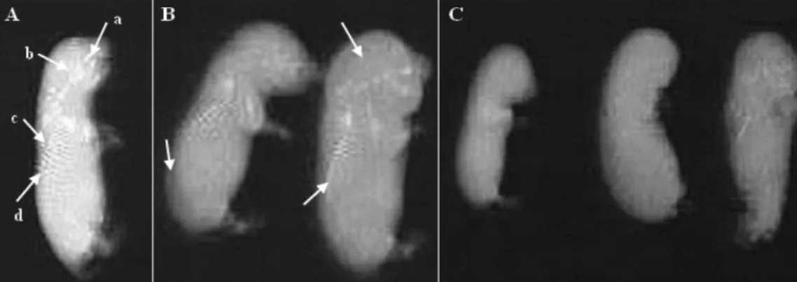 Figure 2 Title: A skeletal radiographic of fetuses from control (A) and chromium-treated rats with 1 mg/kg (B) and 2 mg/kg (C) during the organogenesis period