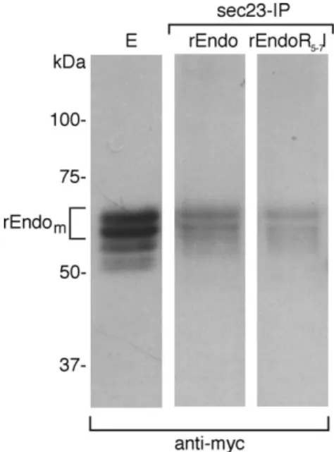Fig. 1. Recombinant rat endomannosidase is localized in the Golgi apparatus.