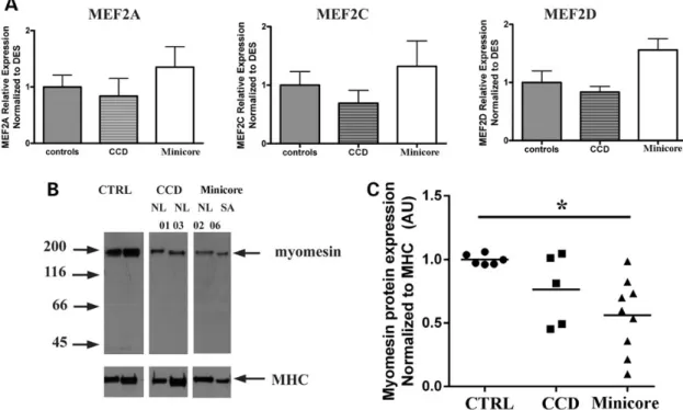 Figure 8.Increased expression of HDAC-4/HDAC-5 leads to a decrease in the content of myomesin, without affecting mef2