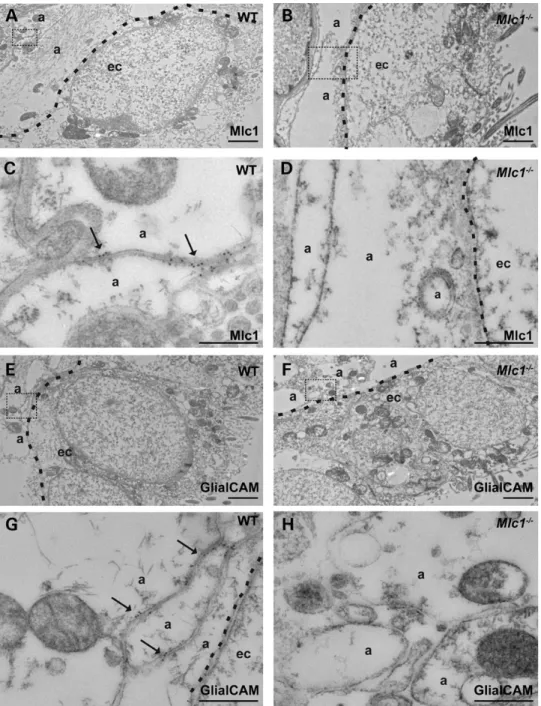 Figure 1. GlialCAM does not localize to astrocyte junctions in subependymal astrocytes in Mlc1 2/2 mice