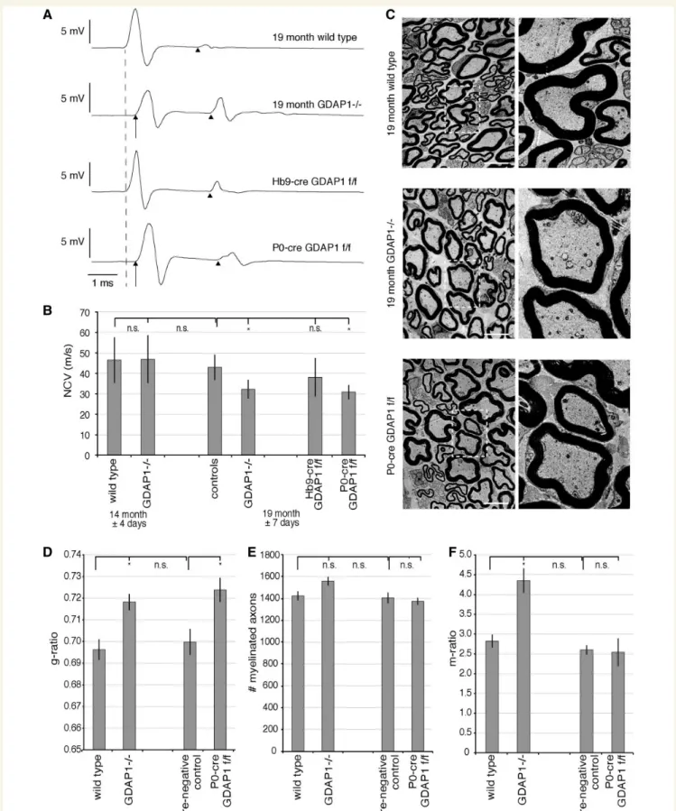 Figure 2 Aged Gdap1 / mice develop a hypomyelinating peripheral neuropathy. (A) Nerve conduction velocity (NCV) measurements of 19-month-old mice with different genotypes are shown as representative original recordings