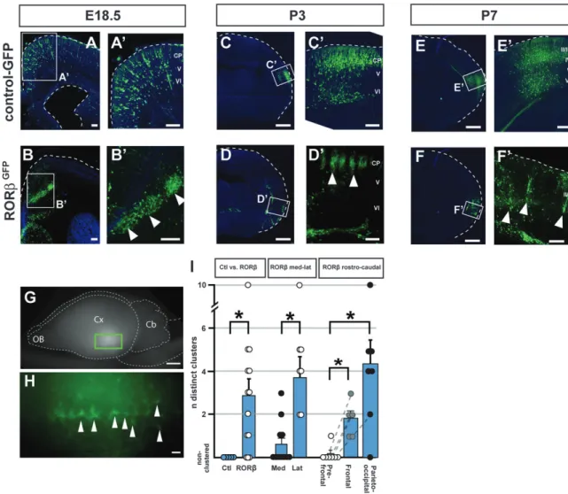 Figure 3. RORb overexpression induces area-specific periodic neuronal clustering. In utero overexpression of RORb at E12.5 induces periodic neuronal clustering in the cortex and subcortical white matter at E18.5 (B,B # , compare with A,A # , where a contro