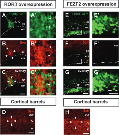 Figure 4. Clusters of RORb-overexpressing neurons are synapse rich. Clustered RORb-overexpressing neurons after in utero electroporation at E12.5 with an RORb-IRES-GFP plasmid have a high synaptic content, as indicated by strong synaptophysin immunoreactiv