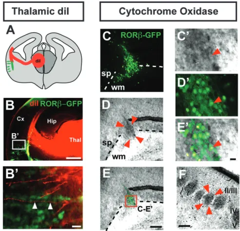 Figure 5. Clusters of RORb-overexpressing neurons colocalize with thalamocortical axons