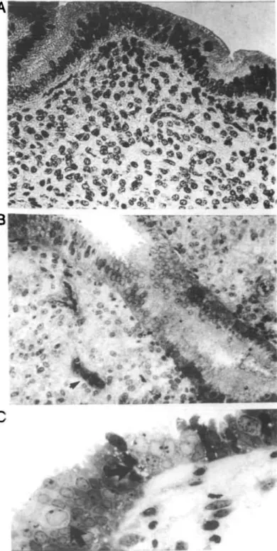 Fig. 3. Endometrium functionalis on day 6 of gestation. Distinctive oedema is seen surrounding a gland in the superficial stroma (A).