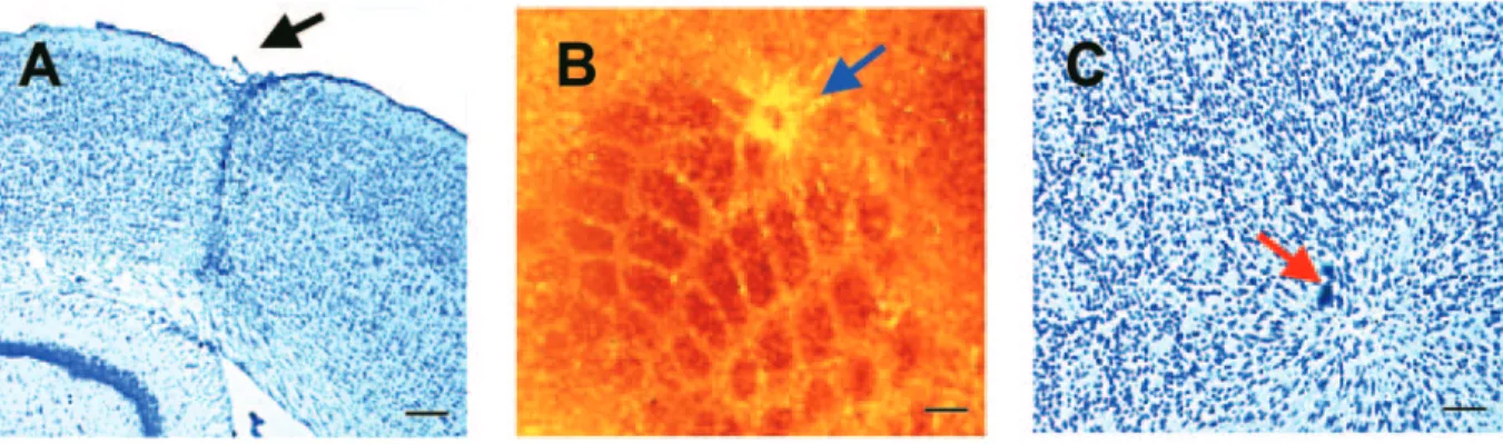 Figure 1. Photomicrographs illustrating the lesion site in the barrel cortex 6 weeks after injury