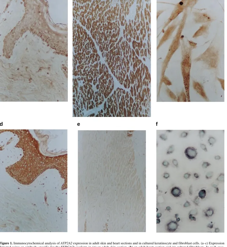 Figure 1. Immunocytochemical analysis of ATP2A2 expression in adult skin and heart sections and in cultured keratinocyte and fibroblast cells