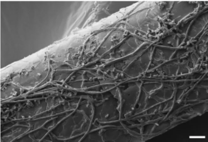 Fig. 1. Scanning electron micrograph of the dermatophyte Arthroder- Arthroder-ma benhamiae colonizing human hair