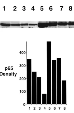 Fig. 3. NF k B was measured by Western blotting the p65 subunit of NF k B. Lane 1 – 4 represent normoxia, lane 5 – 8 hypoxia