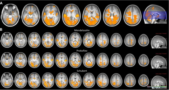 Fig. 2. Factorial analysis for all musical features combined with emotion ratings.