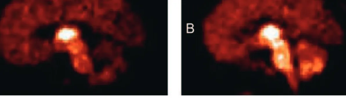 Table 2 F-A-85380 affinity constants on wild-type and mutant human a4b2 receptors