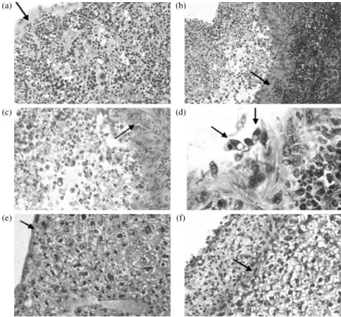 Figure 1. Histological micrographs of splenic (a, b, c and d) and liver (e and f) tissue