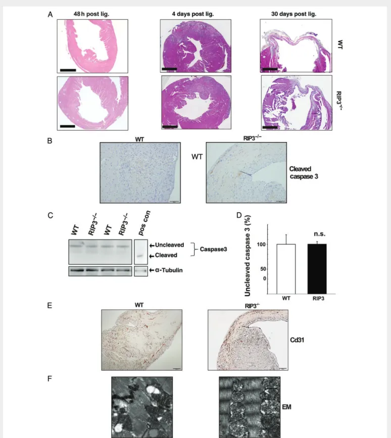 Figure 5 No altered apoptosis rate in infarcted RIP3 2/2 hearts. (A) Representative haematoxylin – eosin stainings of WT and RIP3 2/2 hearts 48 h, 4 days, and 30 days after LAD ligation