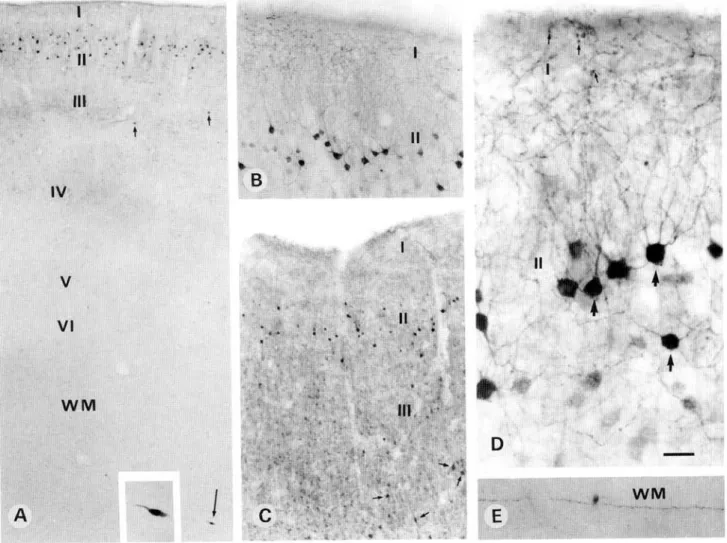 Fig. 7. Light photomicrographs demonstrating CB-ir neurons and puncta in the primary visual area 17