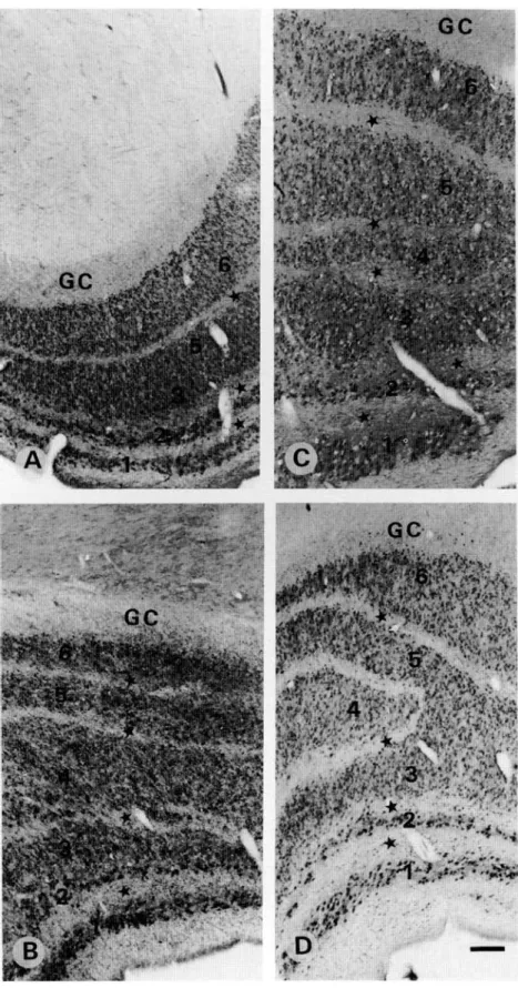 Fig. 1. Light micrographs demonstrating PV immu- immu-noreactivity in the human LGN from different cases.