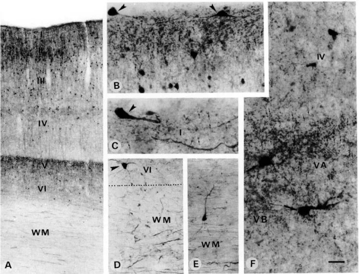 Fig. 6. Light micrographs demonstrating CR-ir neurons and puncta in the primary visual area 17