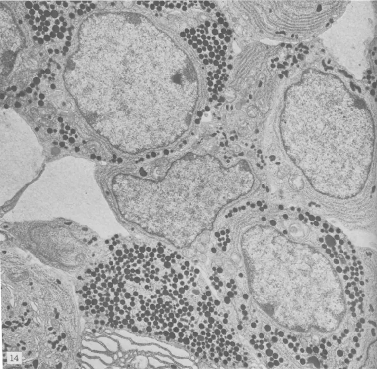 FIGURE  14.--C57BL/6  mouse. Note  prevalence of growth  hormone-secreting cells containing typical round  hormone granuli in cyto- cyto-plasm