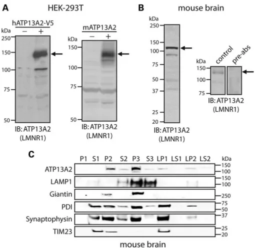 Figure 1. Development of an ATP13A2-specific antibody. (A) HEK-293T cells transiently expressing V5-tagged human ATP13A2 (left panel) or full-length untagged mouse ATP13A2 (right panel) were probed with an antibody to ATP13A2 (LMNR1) to reveal a specific p