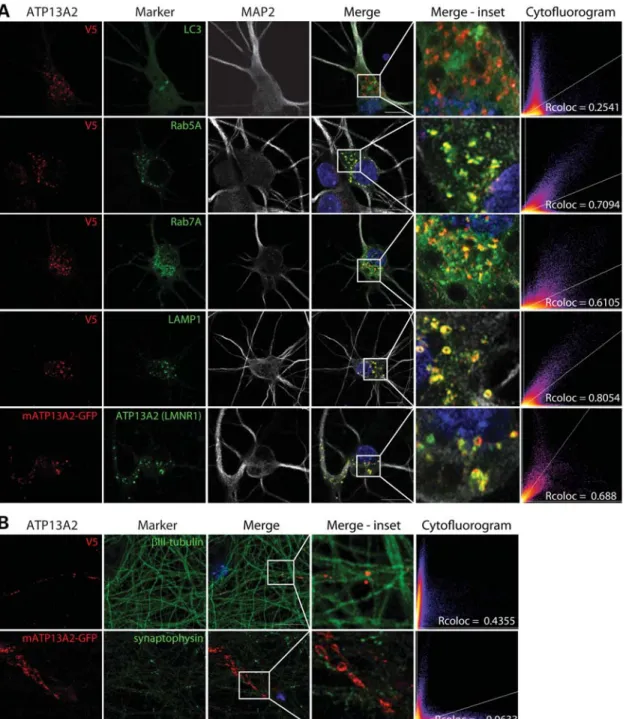 Figure 2. Localization of exogenous ATP13A2 to intracellular acidic vesicles in cortical neurons