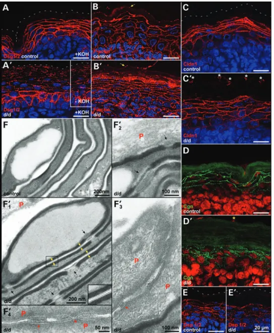 Figure 6. Abnormal SC cohesion and persistent periderm. (A and A ′ ) Desmoglein 1/2 (Dsg1/2) reveals CD persistence throughout mutant epidermis, even without mild alkaline treatment (A ′ , insert)