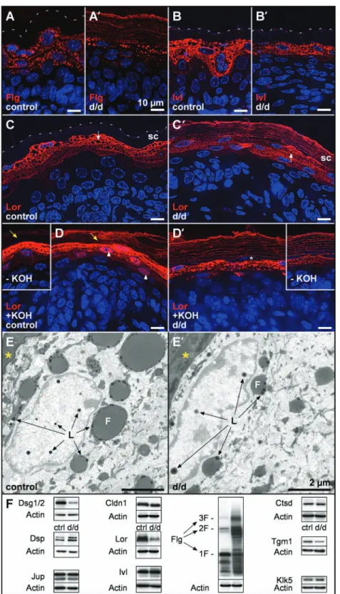 Figure 7. Impaired processing of epidermal proteins. (A and A ′ ) In mutants, (pro)filaggrin (Flg) is weakly expressed within the lower SG, but the CE is intensely delineated
