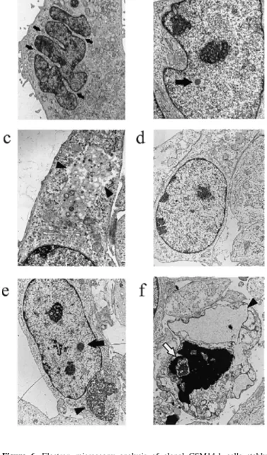 Figure 5. Temperature-dependent cell proliferation and viability of clonal cell lines stably expressing recombinant human full-length ataxin-3 over a time course of 26 days