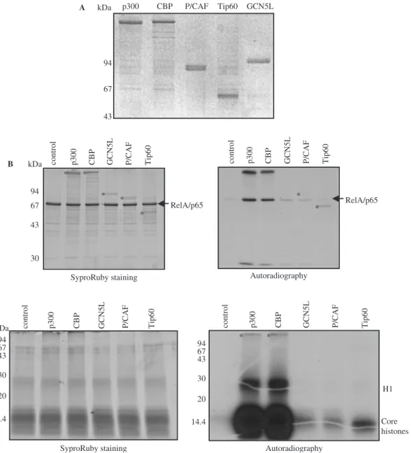Figure 1. RelA/p65 is acetylated by p300 and CBP in vitro. (A) Recombinant histone acetyltransferases (HATs) expressed and puriﬁed from insect cells were analyzed by SDS–PAGE and Coomassie staining
