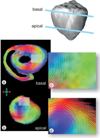 Fig. 1. The papillary muscle from a porcine heart (a) as shown using diffusion tensor imaging (b) and standard histology, with an inset at higher magnification, showing the pathways of diffusion (d) aligned mainly parallel to the long axis of the muscle (c