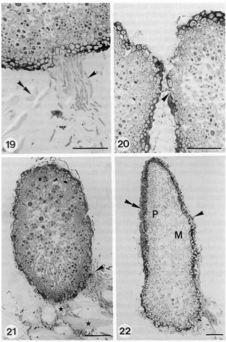FIG. 20. Two diaspores in close contact, 4 months after transplantation. Outgrowing cortical hyphae could penetrate into the neighbouring diaspore (arrowhead)