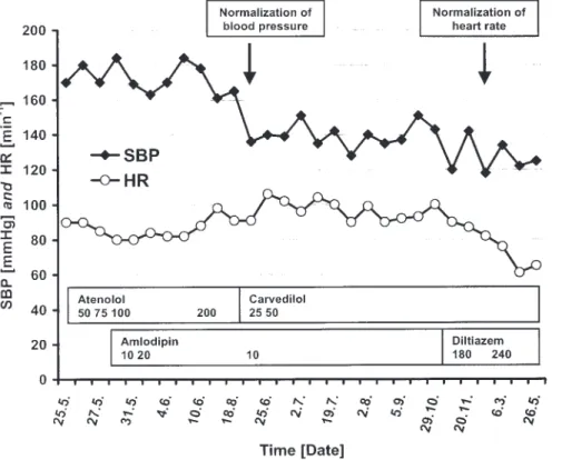 Fig. 1. Heart rate (HR) and systolic blood pressure (SBP) course. Heart rate (circles) and systolic blood pressure (diamonds) are indicated for the ﬁrst year after renal transplantation