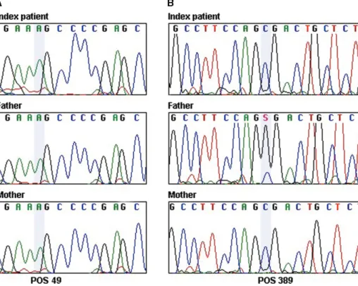 Fig. 2. Sequencing results of b1 receptor polymorphism analysis for the index patient and his father and mother