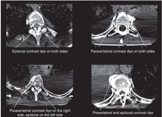 Figure 6 shows different examples of the spread of contrast.