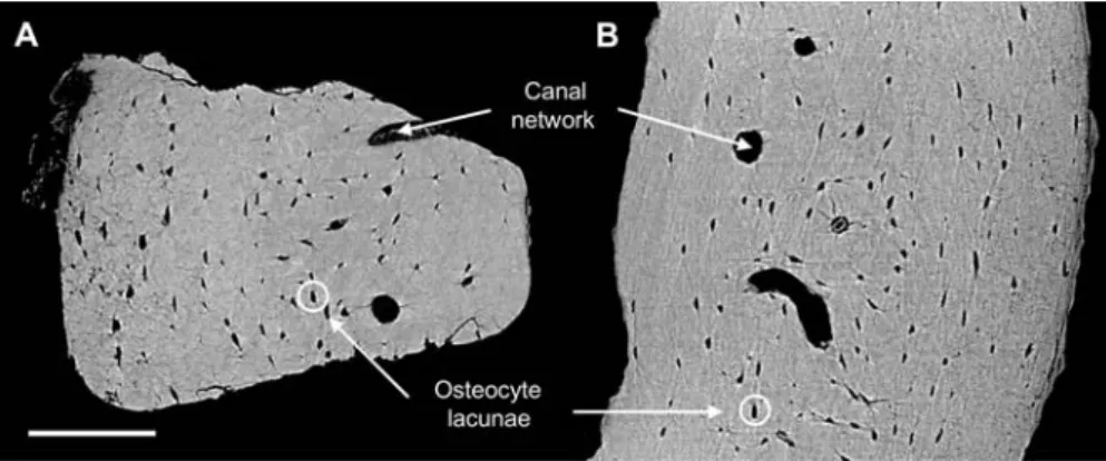 Figure 1 Artifacts arising from mechanical cutting of bone tissue.