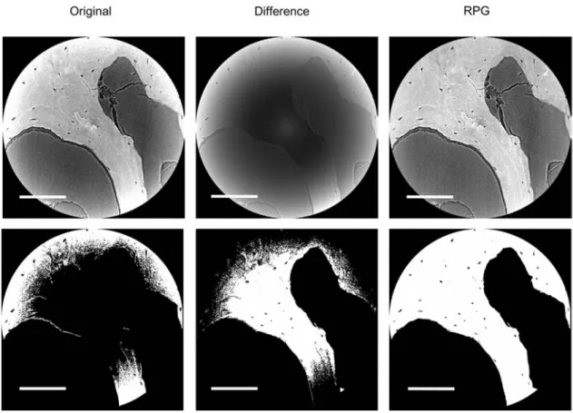 Figure 2 Radial gray value profile correction for local synchrotron radiation-based CT.