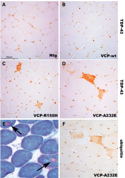 Figure 3. VCP mutant mice show skeletal muscle TDP-43 pathology and rimmed vacuoles evident with Gomori trichrome staining