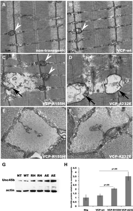 Figure 4. VCP mutant mice show loss of myosin fiber integrity and stabilization of the myosin chaperone protein Unc45b