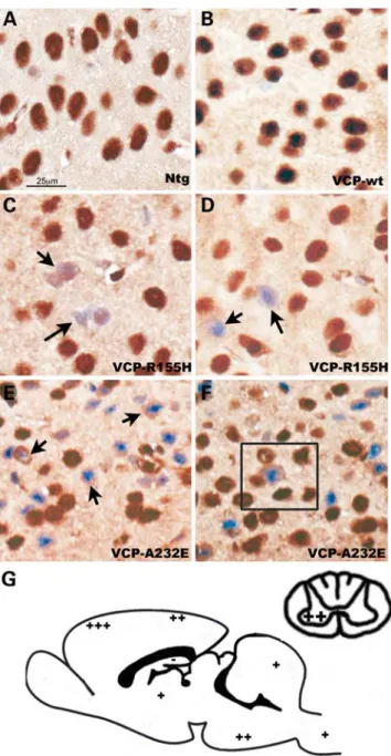 Figure 5. IBMPFD transgenic mice develop ubiquitin- and TDP-43-positive neuropathology