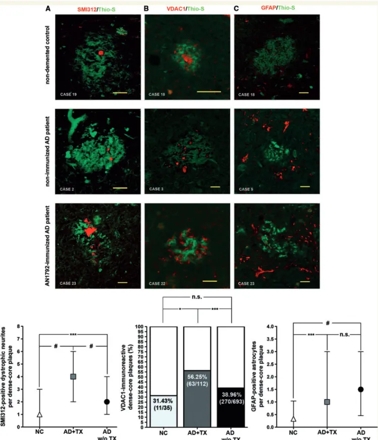 Figure 3 Dense-core plaques remaining after immunization retain some of their toxic properties