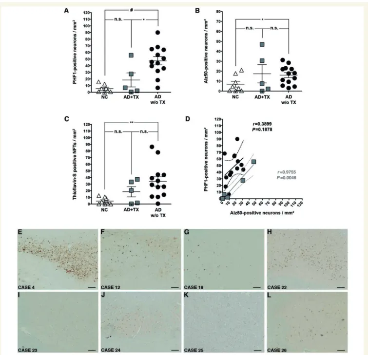 Figure 4 Decreased tau phosphorylation in neurofibrillary tangles after anti-Ab immunization