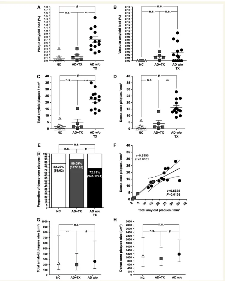 Figure 1 Decreased hippocampal amyloid deposition after anti-Ab immunization. Plaque amyloid load in AN1792-treated Alzheimer’s disease patients is reduced down to the levels of non-demented controls (NC) (A), without significant increase of vascular amylo