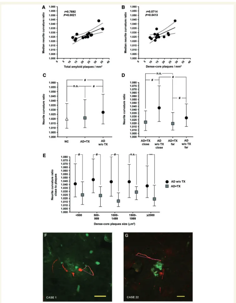 Figure 2 Improvement of neurite trajectories in immunized patients with Alzheimer’s disease