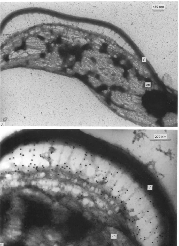 Fig. 3. Immunogold labelling of GM6 with negatively stained whole mount cytoskeleton preparation