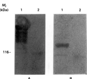 Fig. 4. Western blot analysis of the immunoreactivity of MARP1 and GM6 fusion proteins with Trypanosoma b.