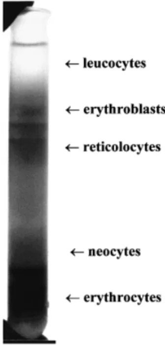 Figure 1. Step density gradient for the enrichment of fetal erythroblasts from maternal blood.